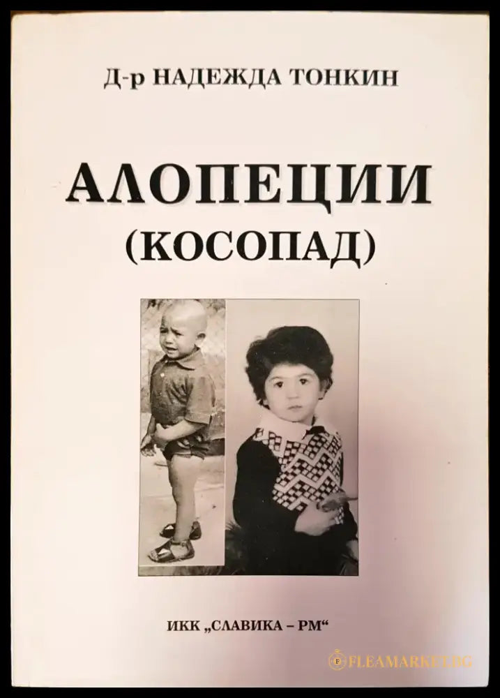 Алопеции косопат - Книги