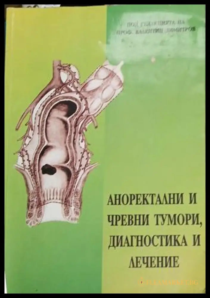 Аноректални и чревни тумори, диагностика и лечение — Валентин Димитров