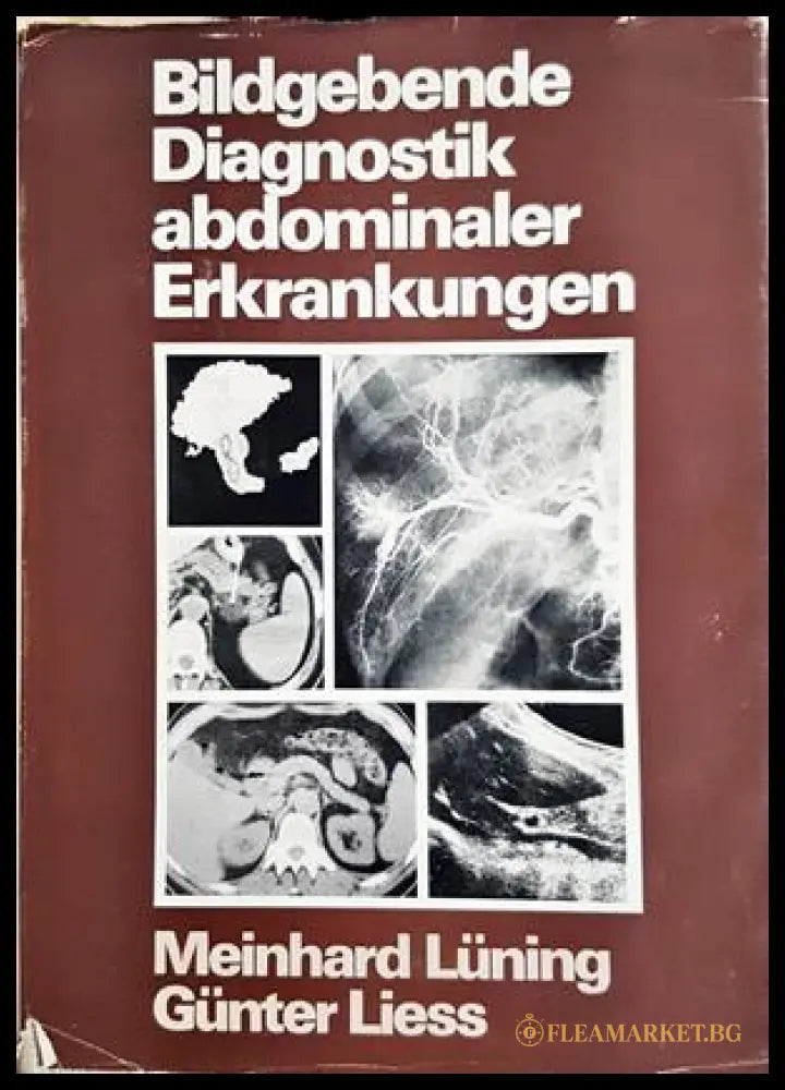 Bildgebende Diagnostik abdominaler Erkrankungen - Lüning, Liess