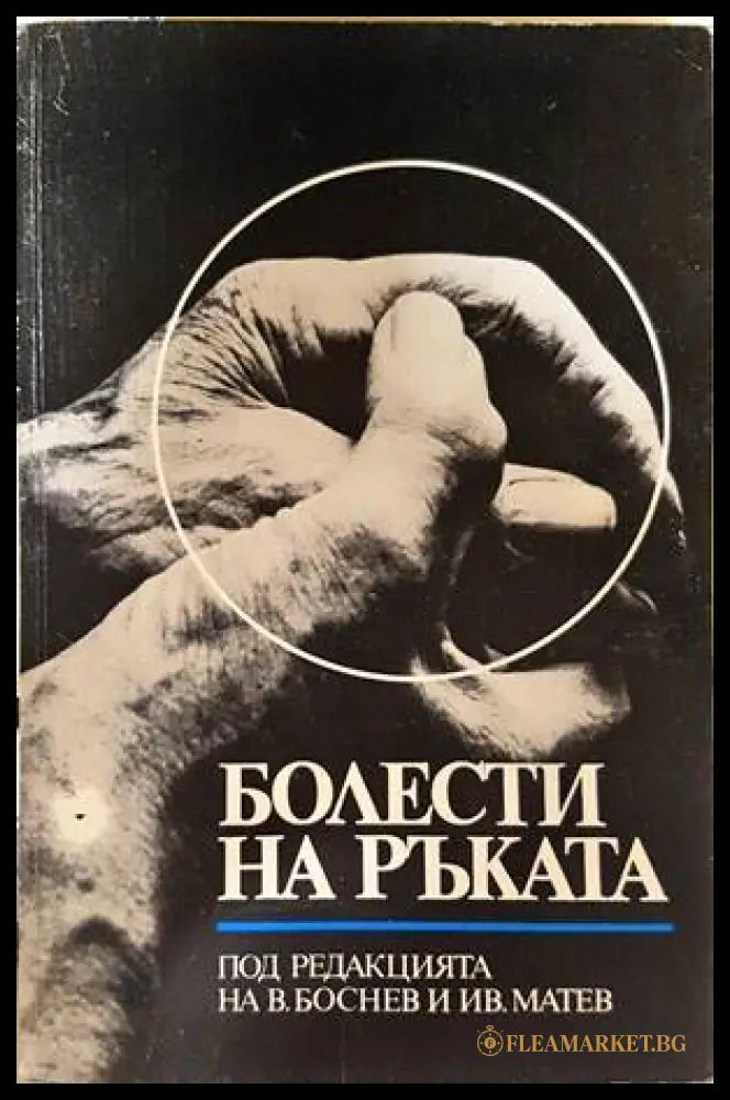 Болести на ръката - Боснев, Матев