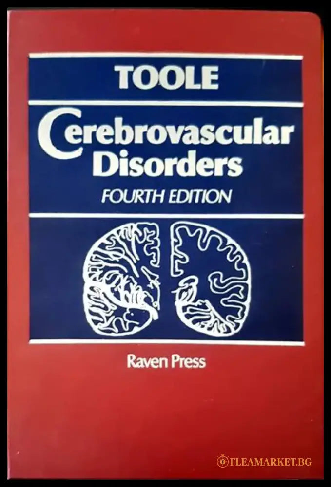 Cerbrovascular disorders - Книги