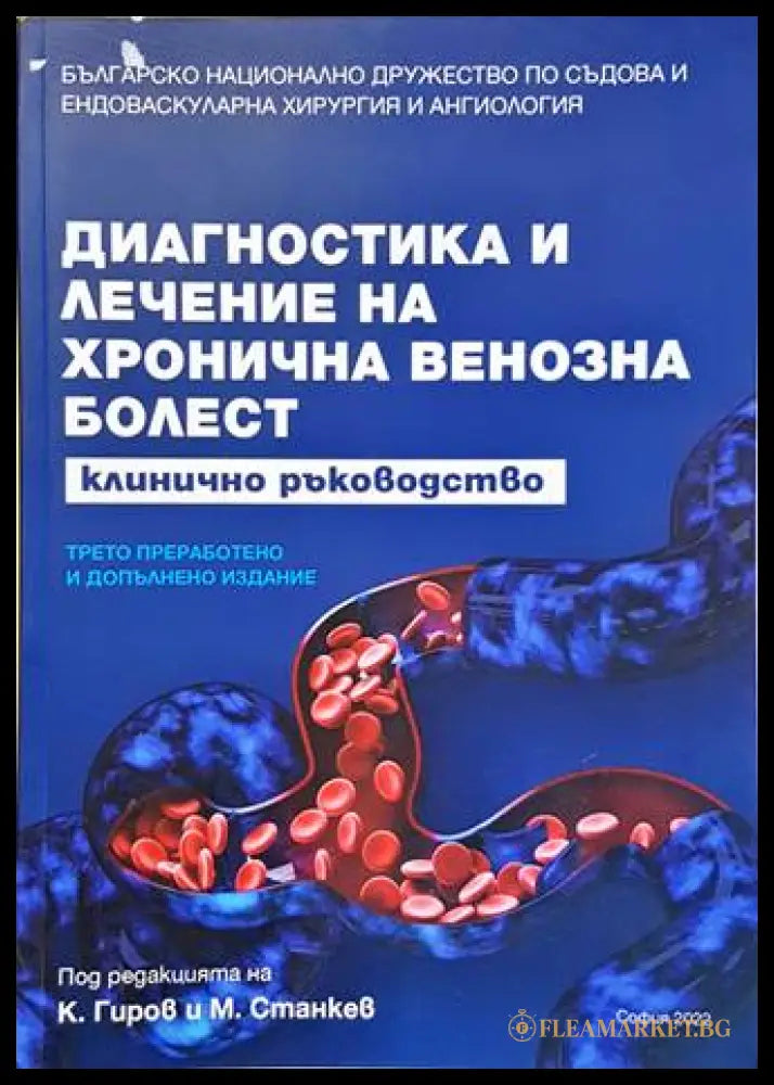 Диагностика и лечение на хронична венозна болест