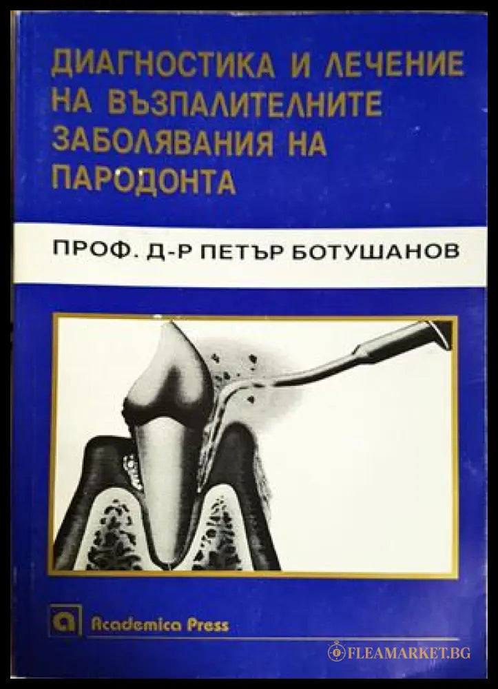 Диагностика и лечение на възпалителните заболявания на пародонта