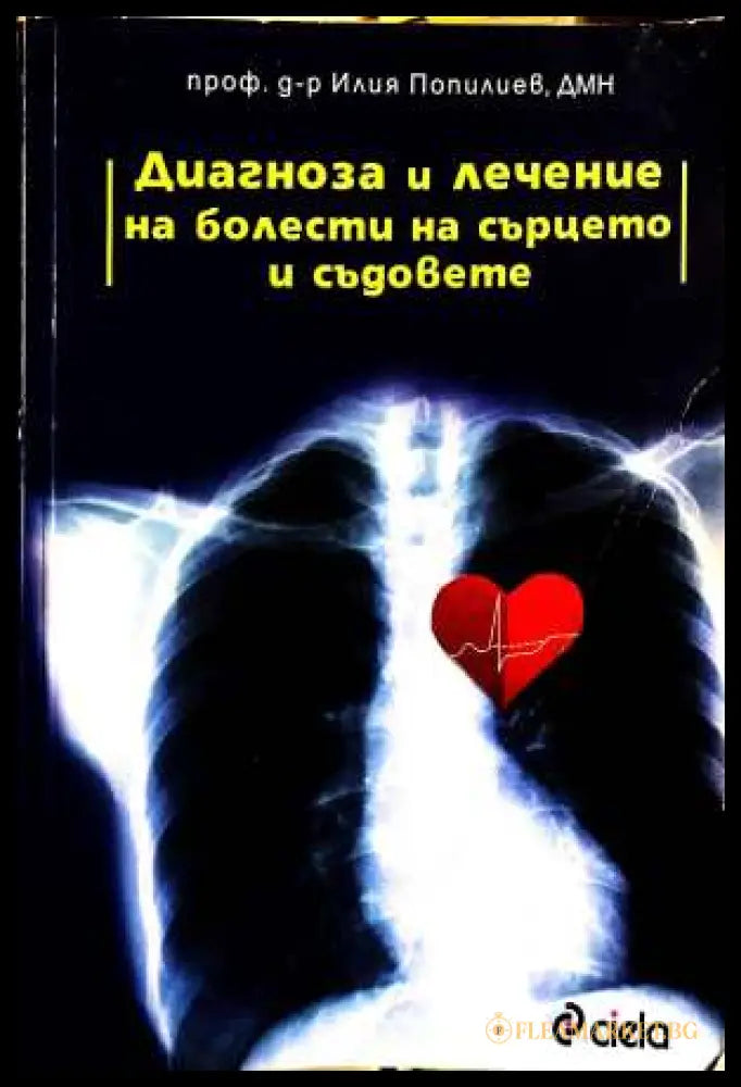 Диагноза и лечение на болести на сърцето и съдовете - Илия Попилиев