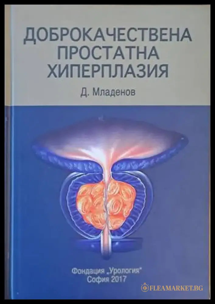 Доброкачествена простатна хиперплазия - Книги