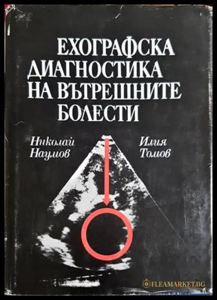 Ехографска диагностика на вътрешните болести - Томов, Наумов