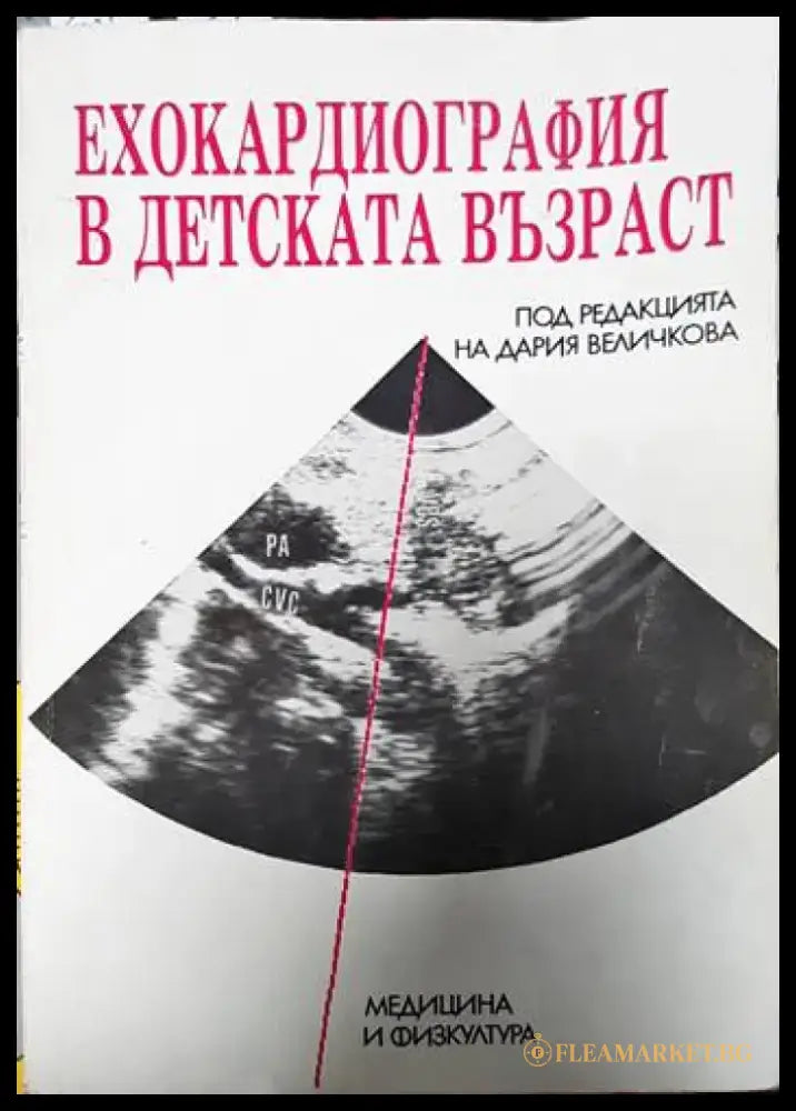 Ехокардиография в детската възраст - Книги