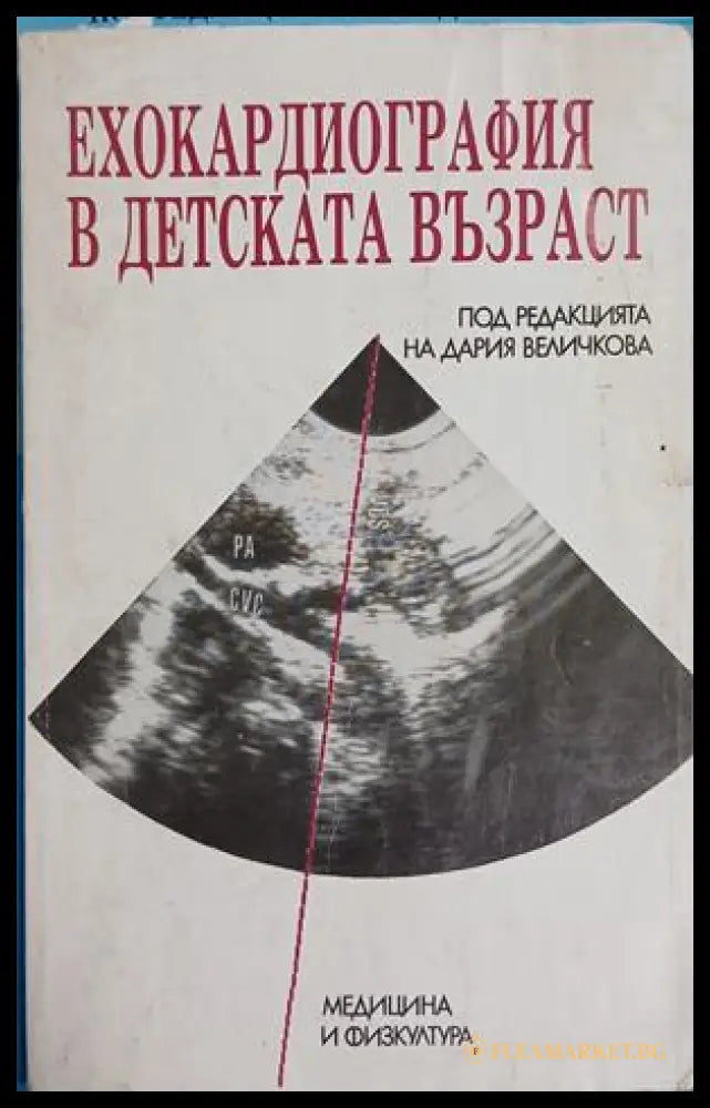 Ехокардиография в детската възраст