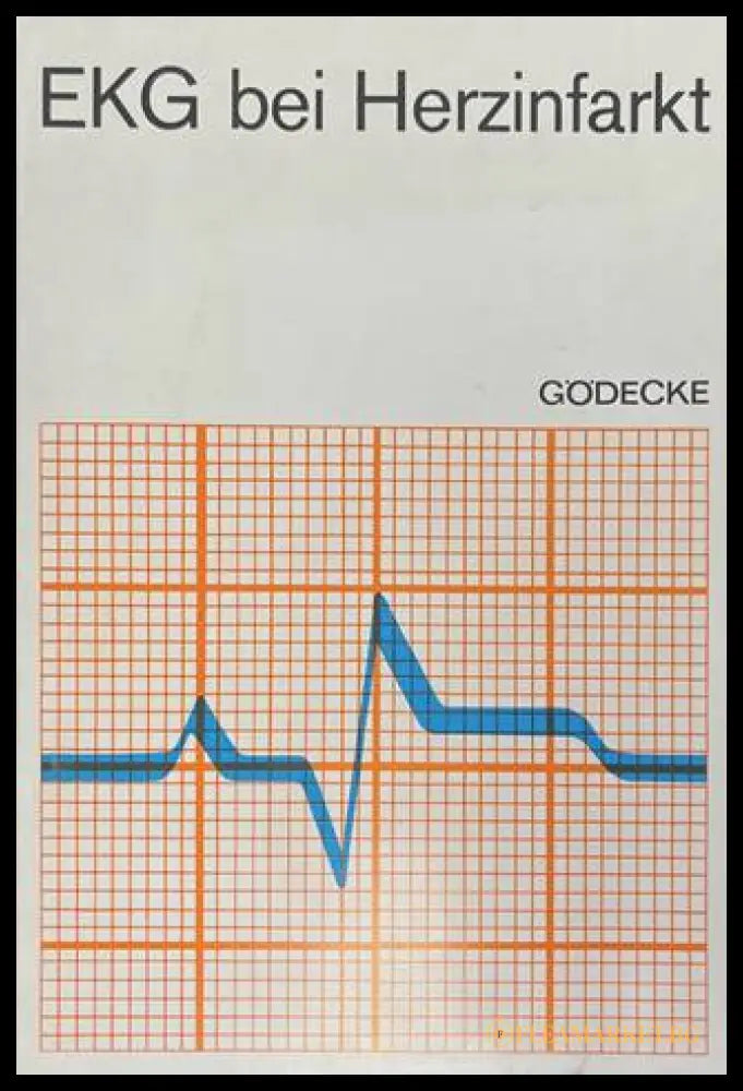 EKG bei Herzinfarkt - корица