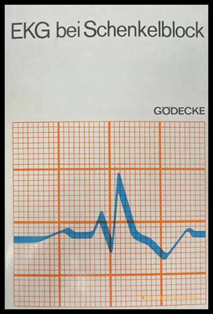 EKG bei Schenkelblock - Gödecke AG