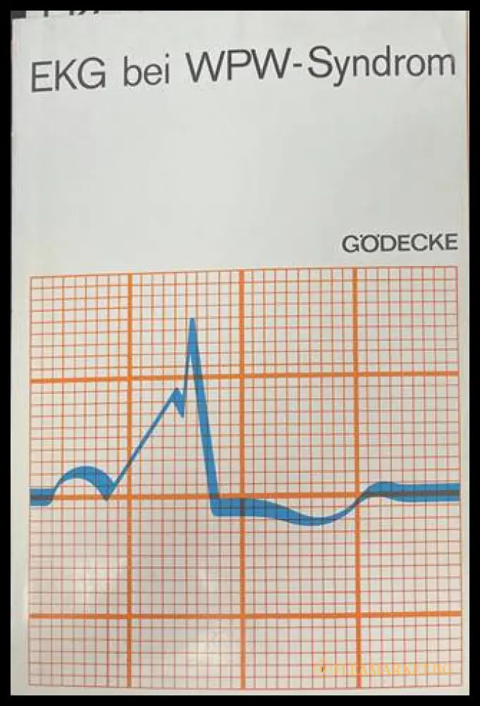 EKG bei WPW-Syndrom - корица