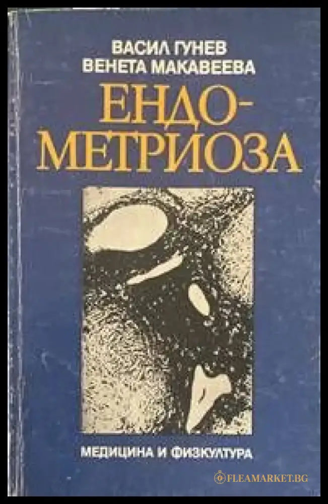 Ендометриоза - Книги