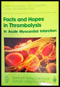 Facts and Hopes in Thrombolysis in Acute Myocardial Infarction