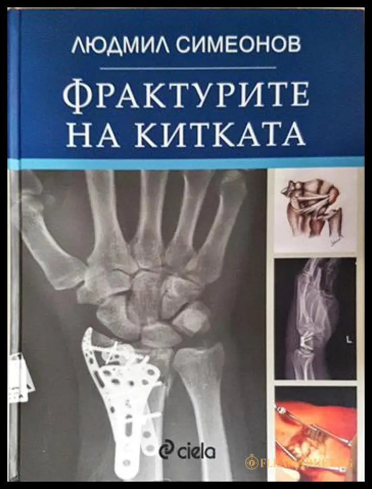 Фрактурите на китката (24060626140500) - Людмил Симеонов - Книга