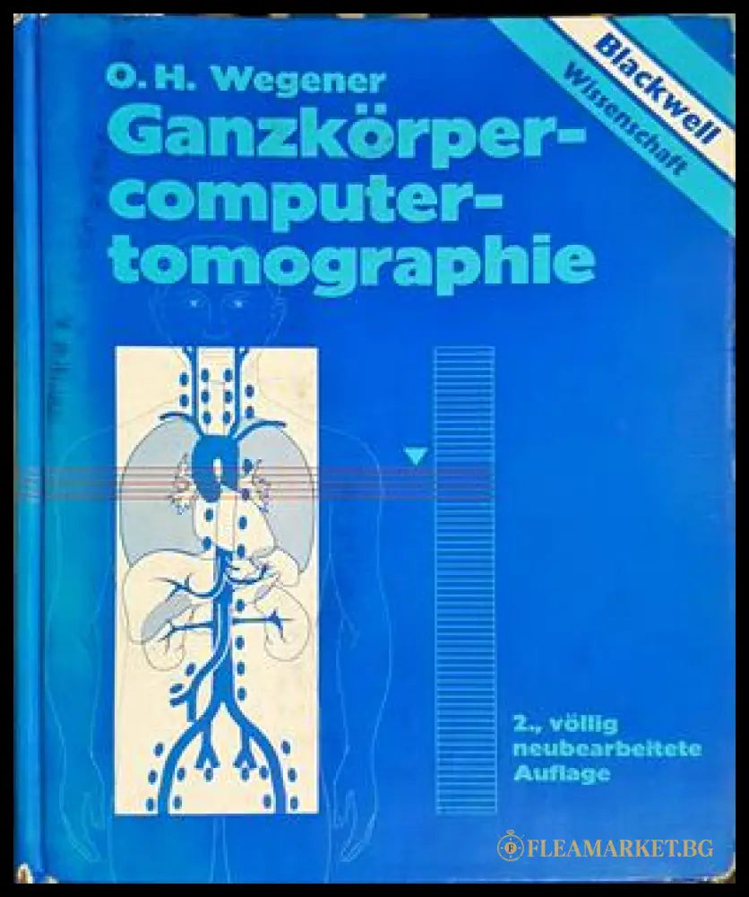 Ganzkörper-computertomographie – O. H. Wegener