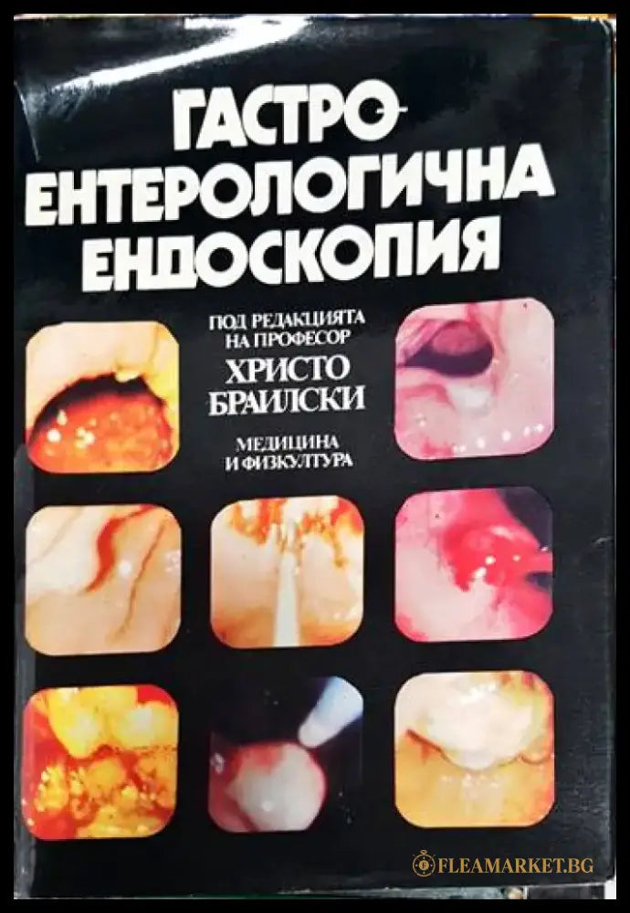 Гастроентерологична ендоскопия - Книга