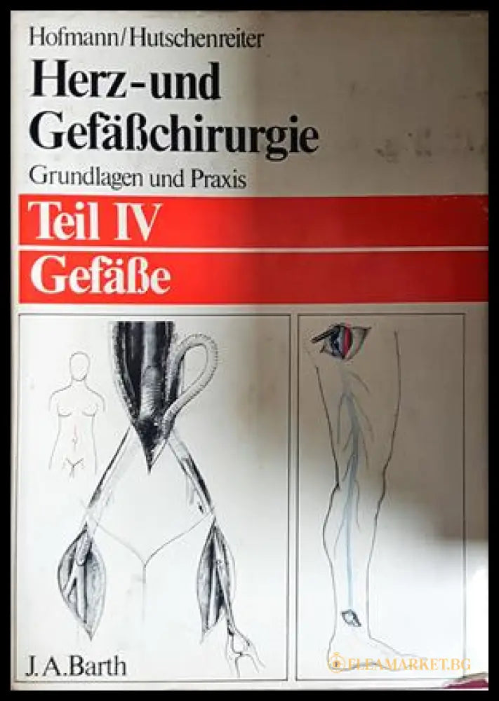 Herz- und Gefäßchirurgie Teil IV Gefäße - Hofmann, Hutschenreiter