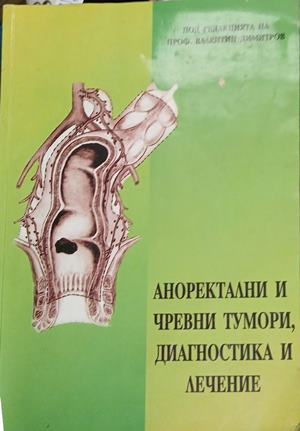Аноректални и чревни тумори, диагностика и лечение — Валентин Димитров