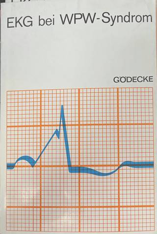 EKG bei WPW-Syndrom - корица