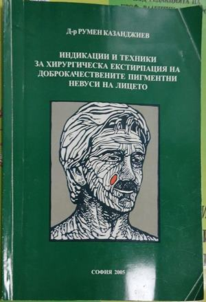 Индикации и техники за хирургическа екстирпация на доброкачествените пигментни невуси на лицето — Румен Казанджиев