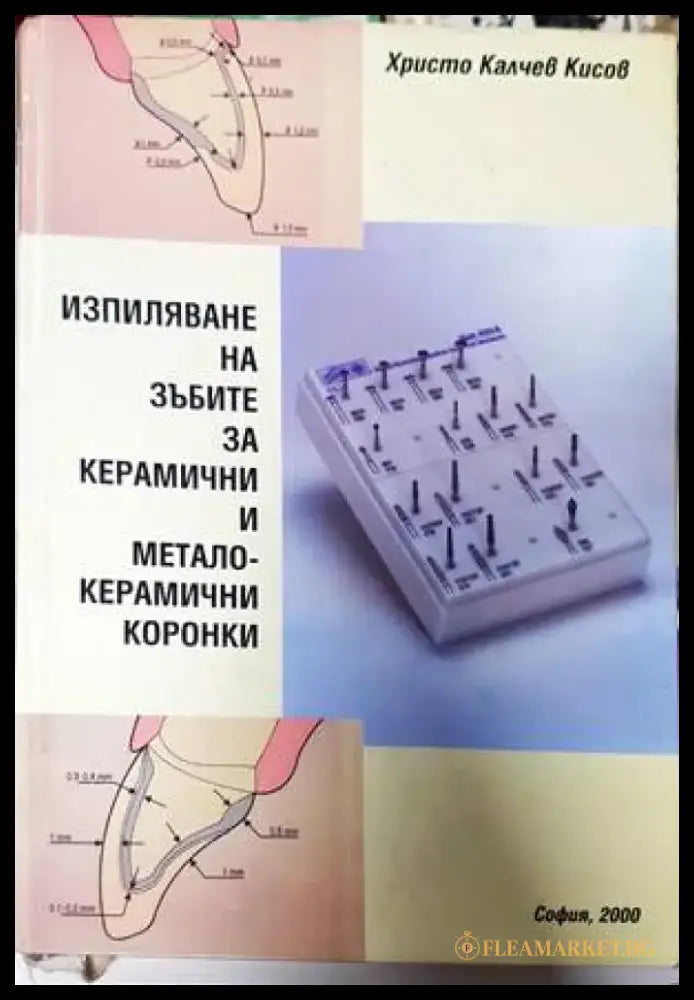 Изпиляване на зъбите за керамични и металокерамични коронки - Книги