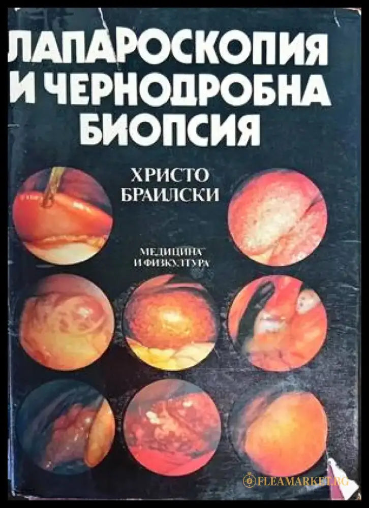 Лапароскопия и чернодробна биопсия - Книги