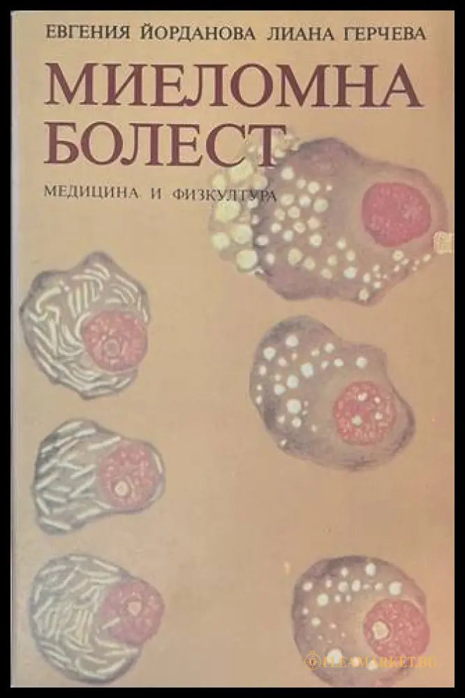 Миеломна болест - корица
