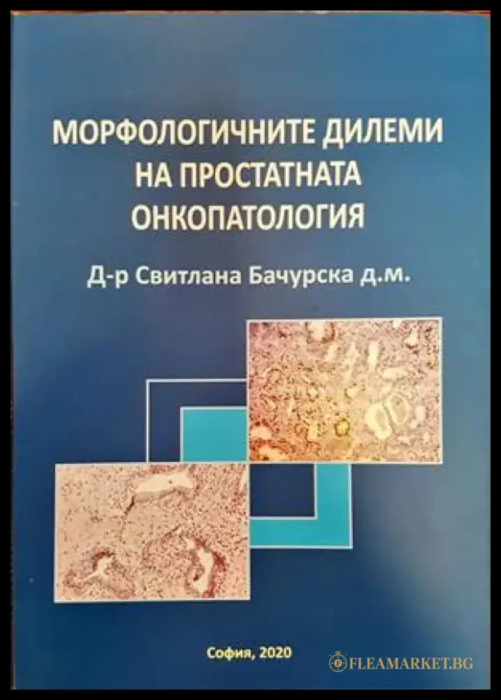 Морфологичните дилеми на простатната онкопатология - Книги