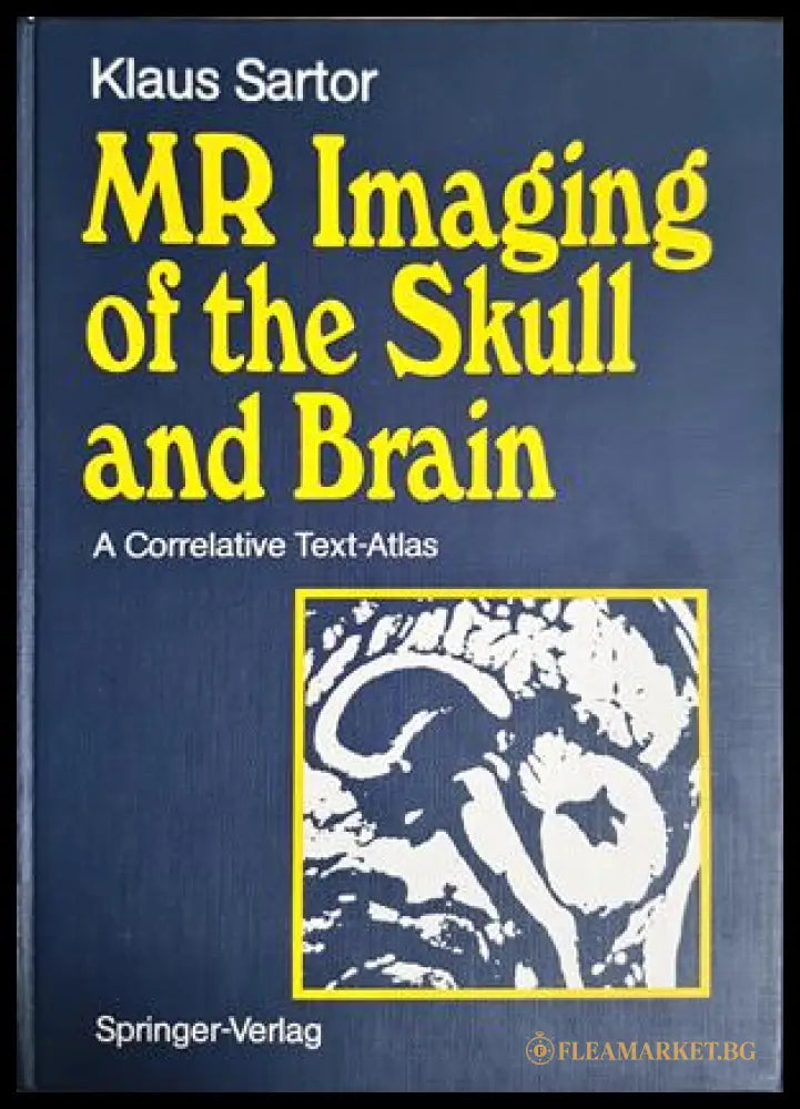 MR Imaging of the Skull and Brain – Klaus Sartor