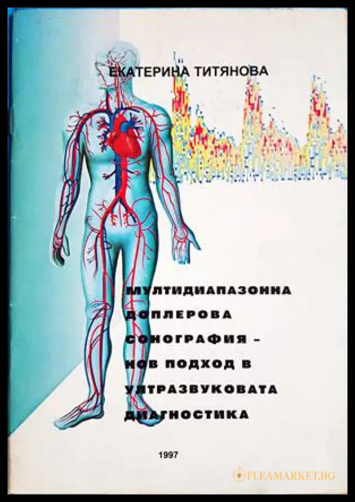 Мултидиапазонна доплерова сонография - Екатерина Титянова