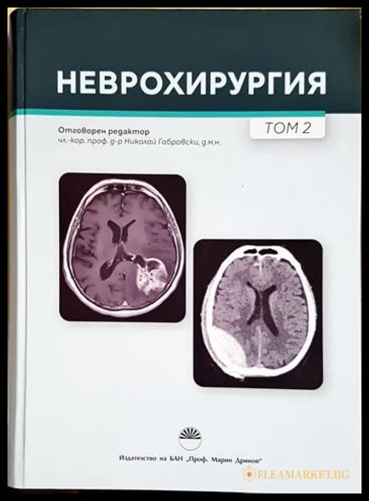 Неврохирургия. Том 2 (24060626145200) - Колектив (отг. ред. чл.-кор. проф. д-р Николай Габровски) - Книга