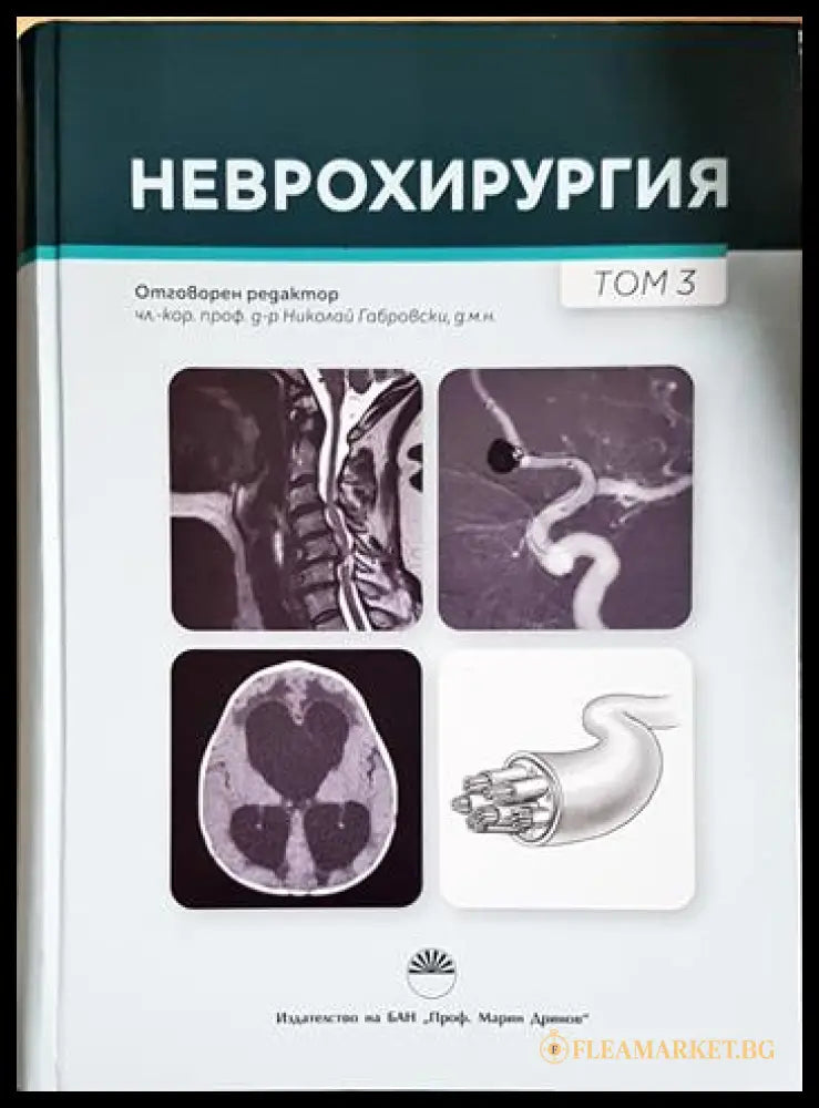 Неврохирургия. Том 3 (240606261449) - Колектив - Книга