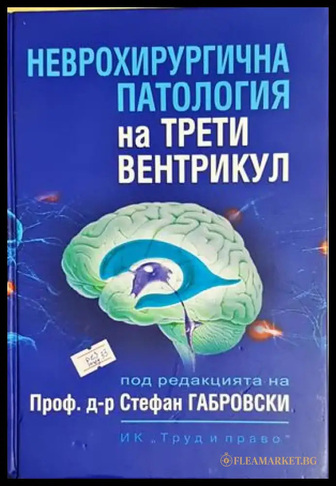 Неврохирургична патология на трети вентрикул - Колектив (1802) - Книга