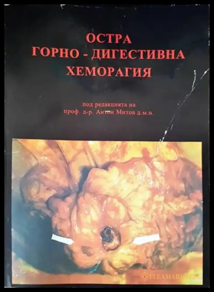 Остра горно-дигестивна хеморагия - Книги