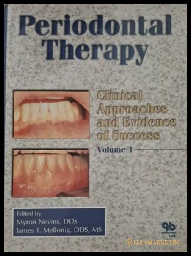 Periodontal Therapy & Implant Therapy. Volume 1-2 (182006261353) - Колектив (Myron Nevins James T. Mellonig) - Книга