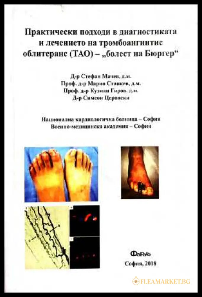 Практически подходи ТАО - болест на Бюргер
