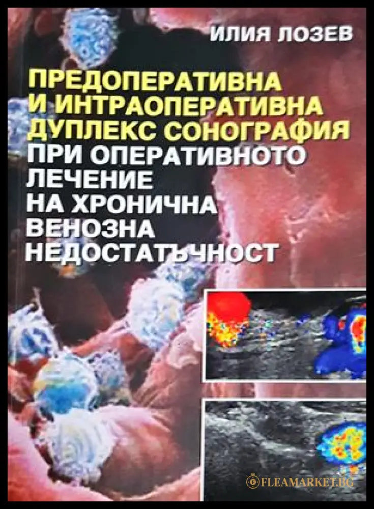 Предоперативна и интраоперативна дуплекс сонография - корица