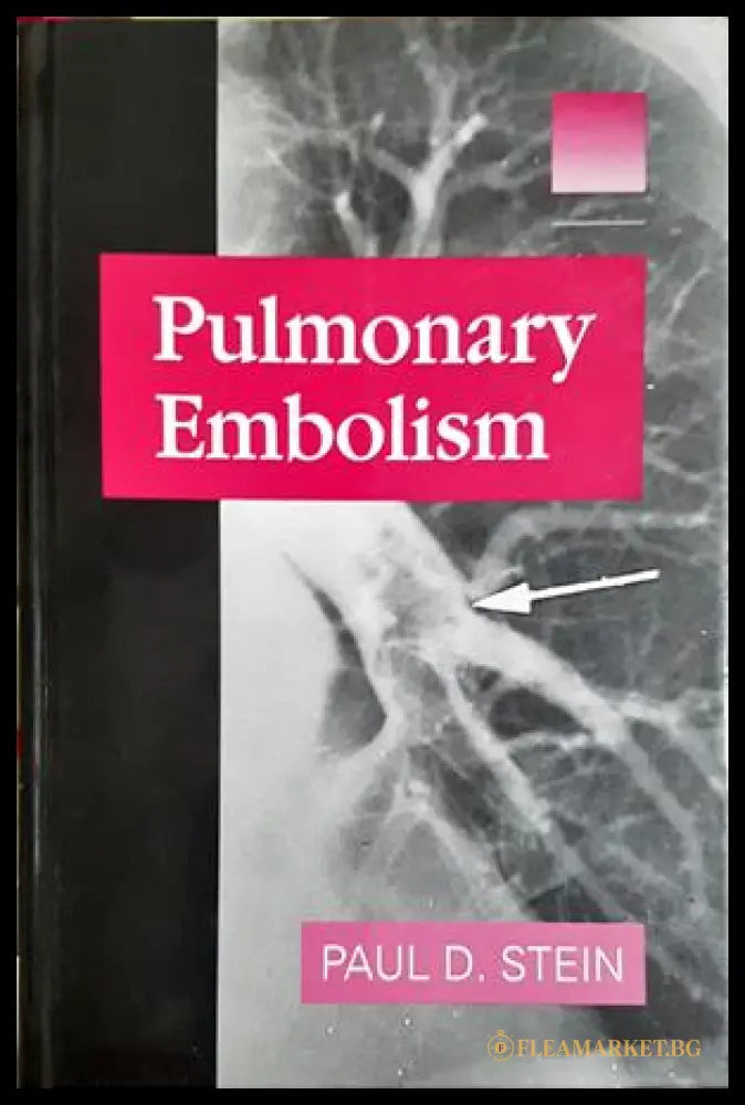 Pulmonary Embolism - Paul D. Stein - корица