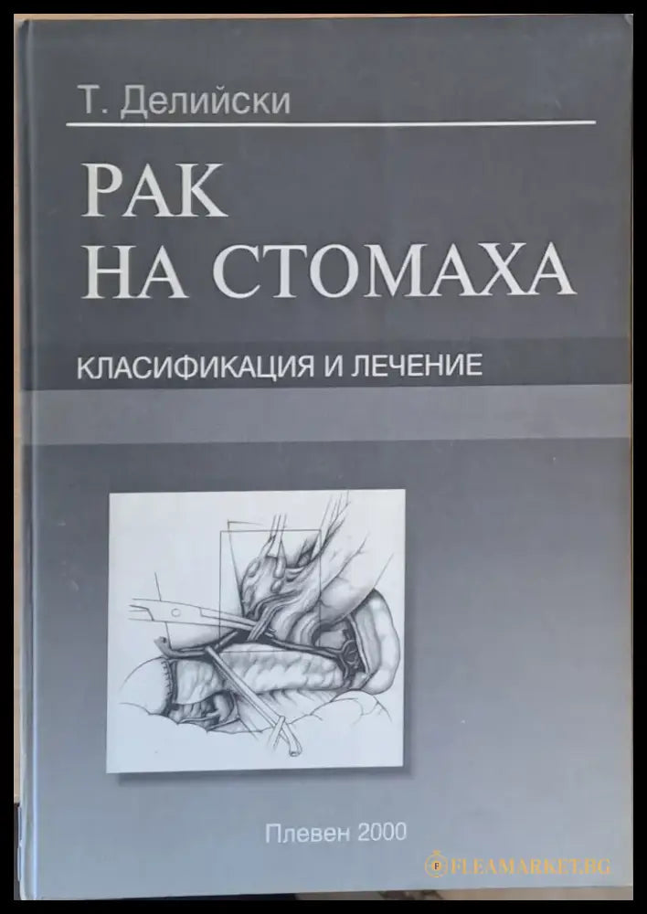 Рак на стомаха Класификация и лечение - Книги