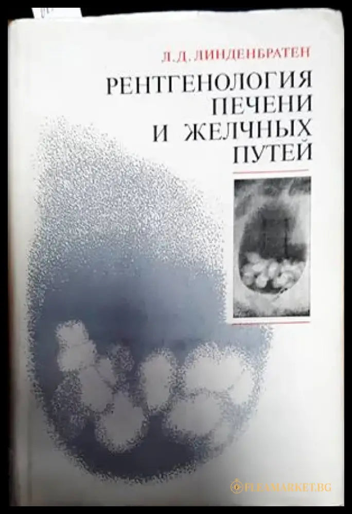 Рентгенология печени и желчных путей - Книги