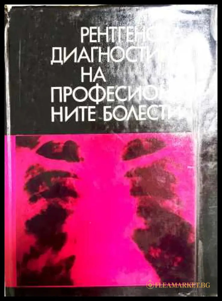 Рентгенова диагностика на професионалните болести