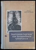 Рентгенови картини при белодробната туберкулоза (791) - Книга