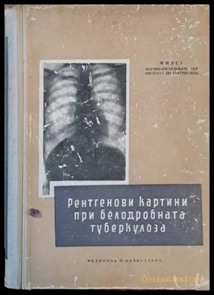 Рентгенови картини при белодробната туберкулоза (791) - Книга