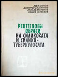 Рентгенови образи на силикозата и силикотуберкулозата (1798) - Книга