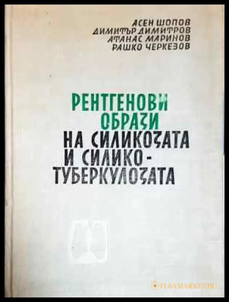 Рентгенови образи на силикозата и силикотуберкулозата (1798) - Книга