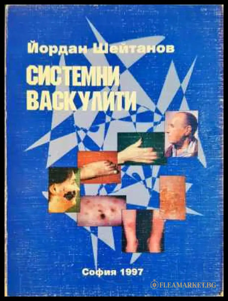 Системни васкулити - Йордан Шейтанов