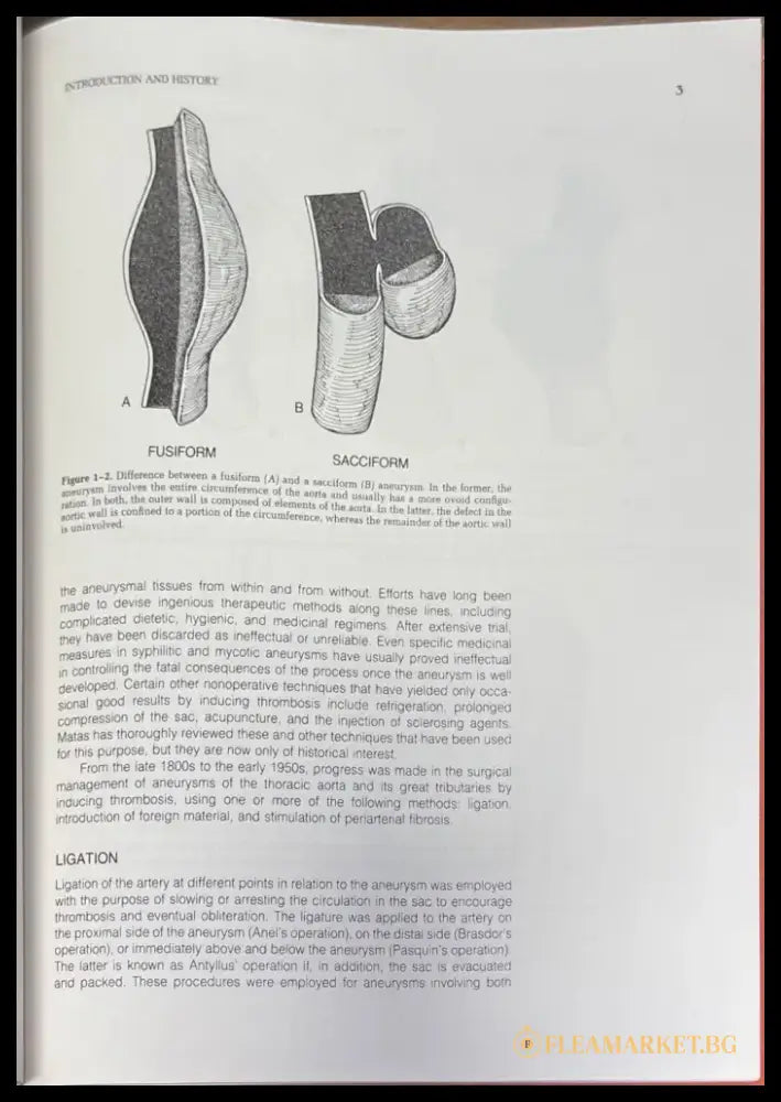 Surgical treatment of aortic aneurysms - Книги
