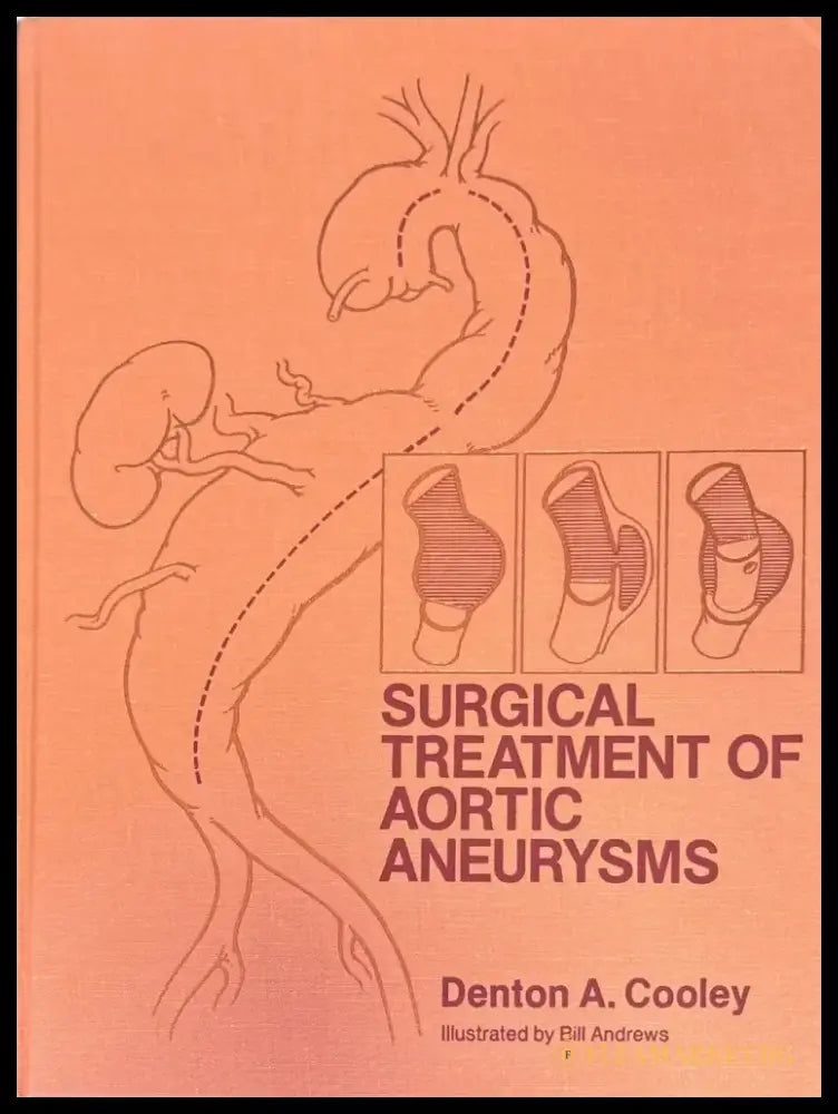 Surgical treatment of aortic aneurysms - Книги
