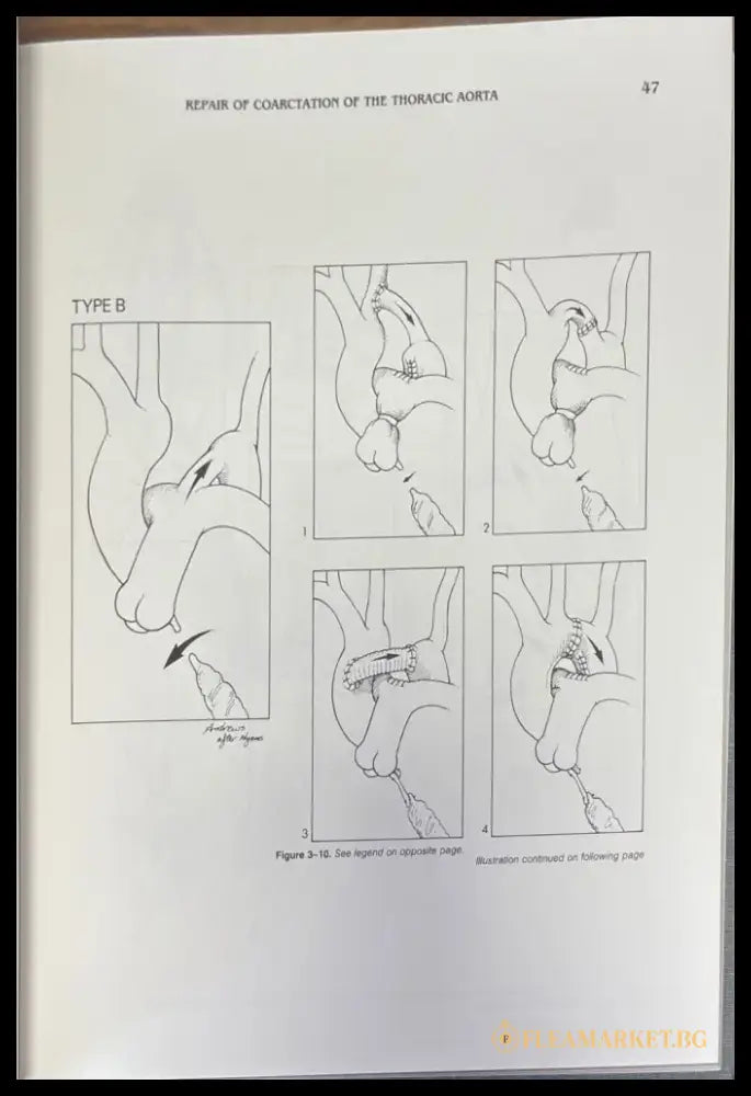 Techniques in cardiac surgery. Second edition - Книги
