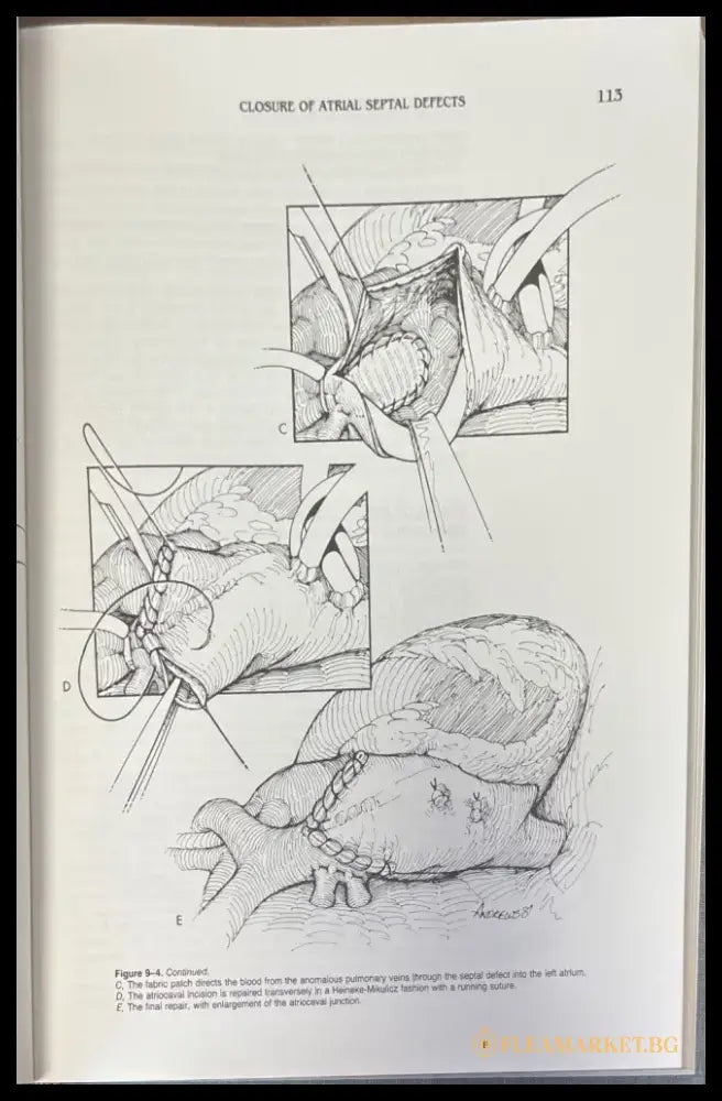 Techniques in cardiac surgery. Second edition - Книги